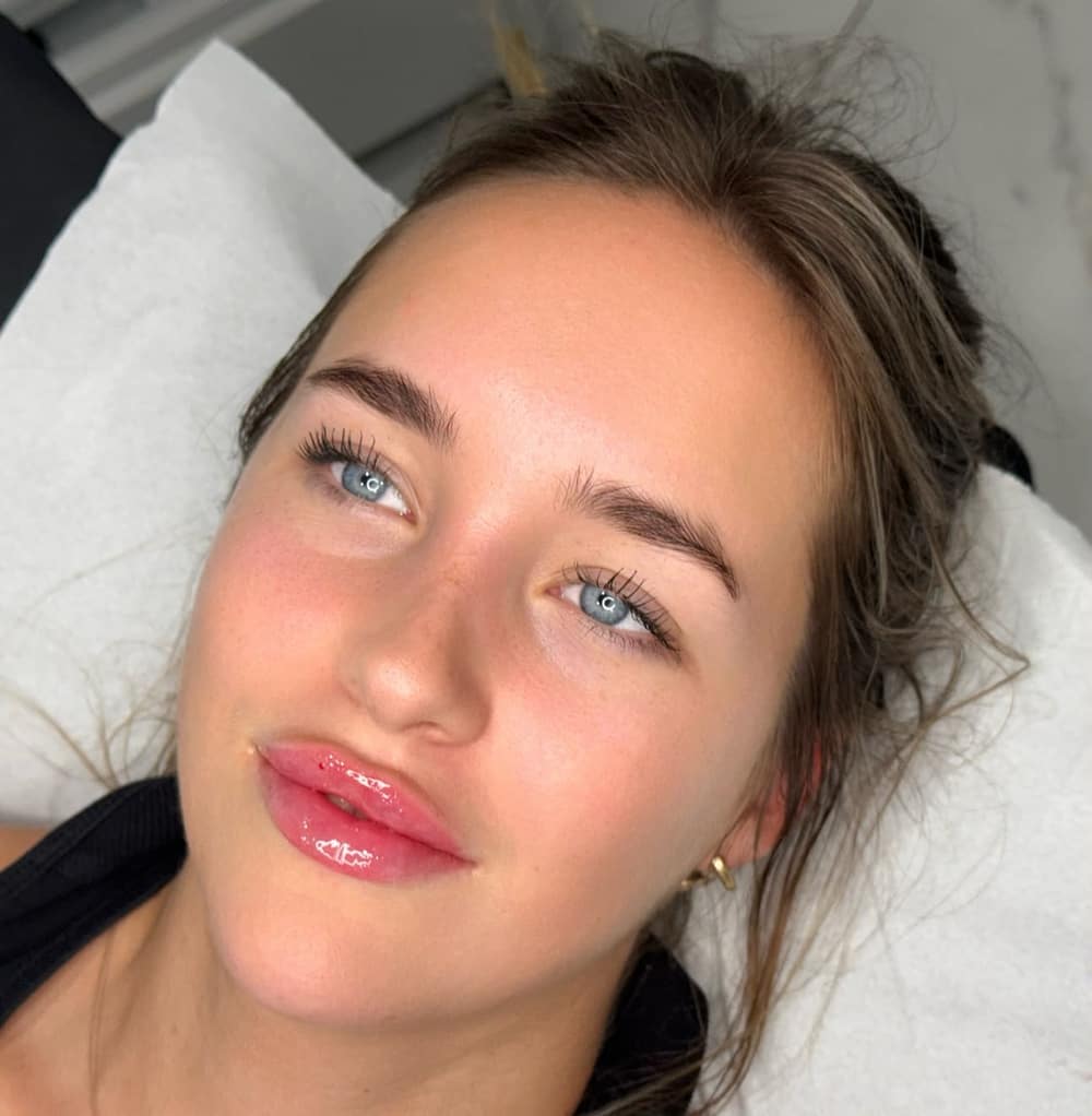 Dermal Fillers at Lady Young's Beauty & Cosmetics, Bracknell