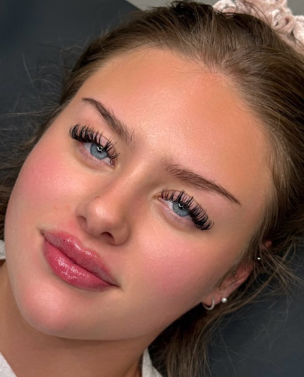 Client after lip enhancement at Lady Young's — soft, natural volume with a glossy finish