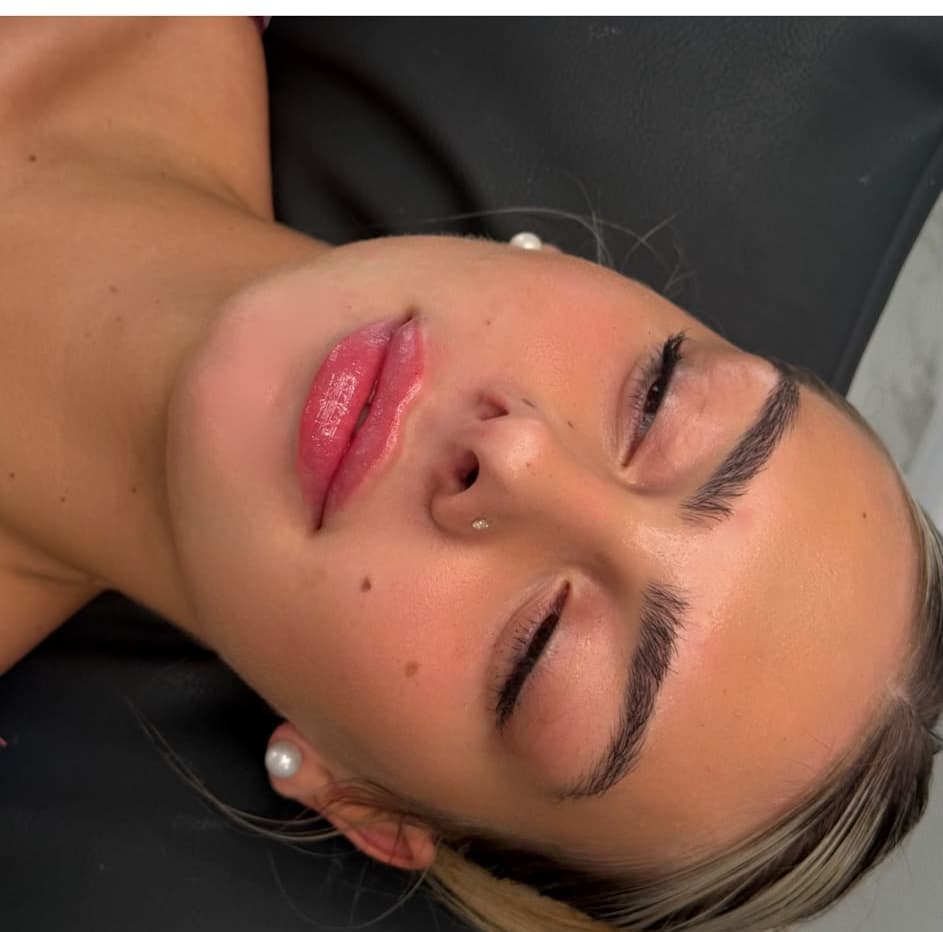Defined, balanced lips after treatment by Safina Young